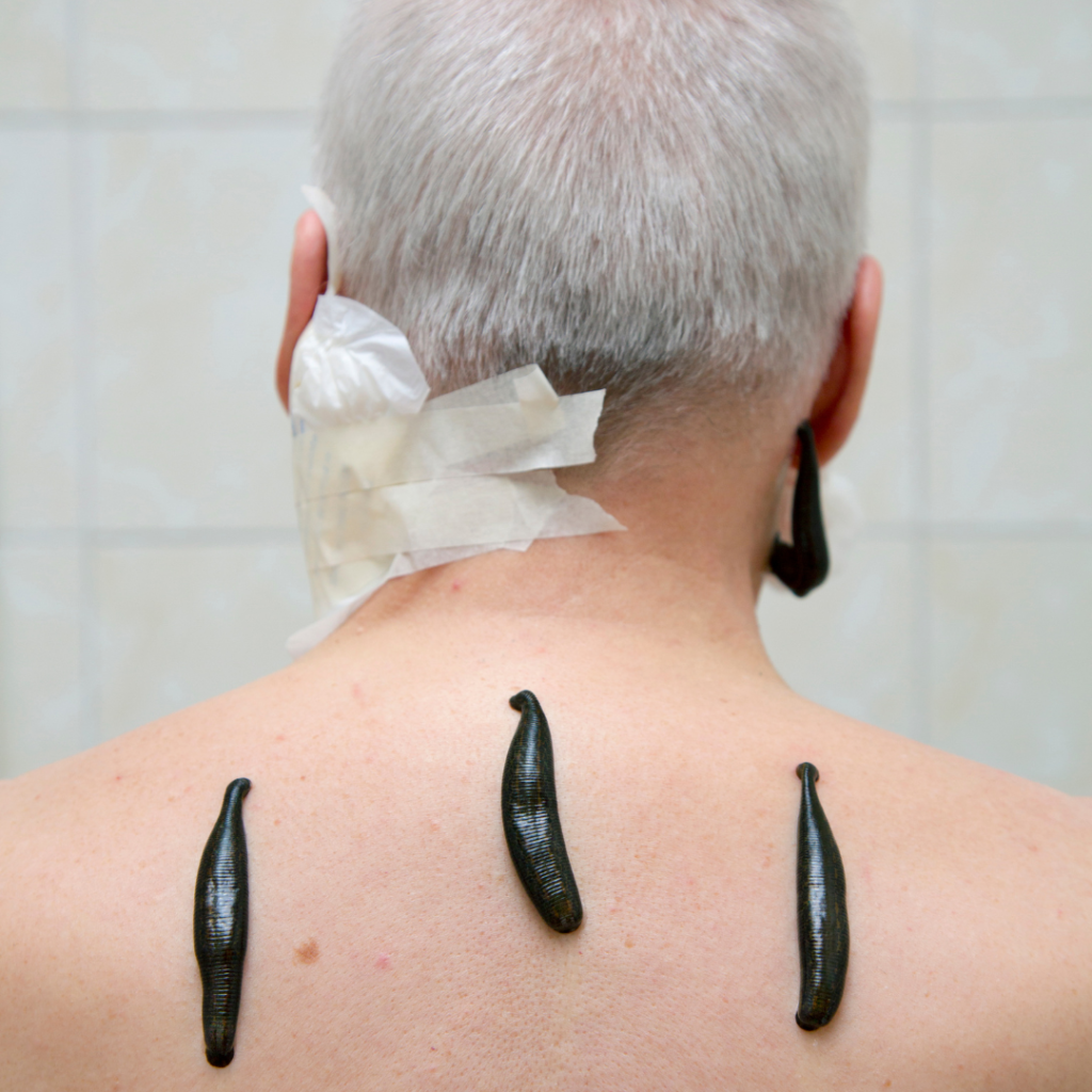 Ayurveda Panchakarma Treatment In Hyderabad
